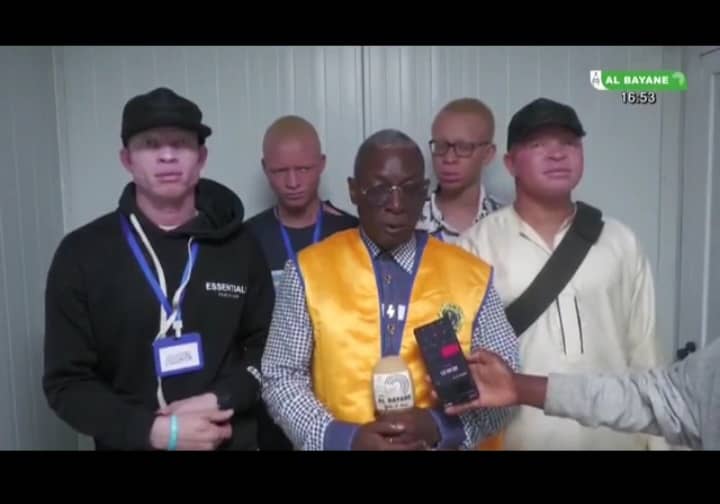 Protection et Solidarité : Distribution de Crèmes Solaires aux Albinos à Korhogo